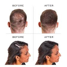 The hair fibers are charged with static electricity and will bond with your own hair. Hairline Hair Shade Scalp Concealer For Thinning Balding With Dht Blockers Saw Palmetto Rosemary Extract For Hair Loss Grey Root Touch Up More Natural Than Hair Fibers Hair Line Powder Beauty Amazon Com