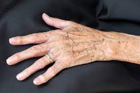 Dunne Haut Ursachen Symptome Und Therapie Heilpraxis