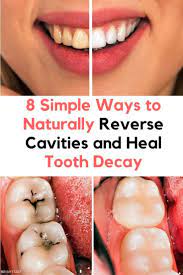 8 Simple Ways To Naturally Reverse Cavities And Heal Tooth Decay Heal Cavities Reverse Cavities Dental Decay