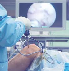 For patients without health insurance, a total knee replacement can cost $35,000 or more. Knee Replacement Surgery Cost In Hyderabad India