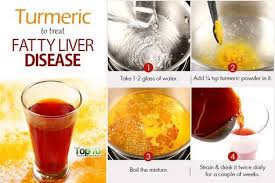 Home Remedies For Fatty Liver Disease Top 10 Home Remedies Fatty Liver Disease Liver Detox Liver Cleanser