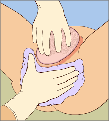 Maybe you would like to learn more about one of these? Perineal Tear Wikiwand