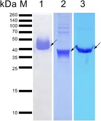Ptd 159485, plot 2a, jalan kempas lama, kempas lama, skudai johor bahru, johor, malaysia 81300 , johor malezya. A Lateral Flow Rapid Test For Human Toxocariasis Developed Using Three Toxocara Canis Recombinant Antigens In The American Journal Of Tropical Medicine And Hygiene Volume 98 Issue 1 2017