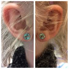 Ear Piercings Uneven February 2018 Babies Forums What To Expect