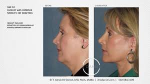 Louisville Plastic Surgery Center