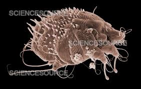 Image result for Sarcoptes scabiei