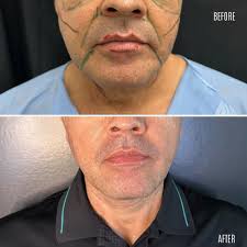 𝐃𝐑 𝐍𝐎𝐑𝐀 𝐒𝐓𝐀𝐍𝐅𝐎𝐑𝐃 𝐏𝐥𝐚𝐬𝐭𝐢𝐜 S𝐮𝐫𝐠𝐞𝐨𝐧