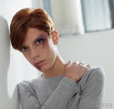 Moon facies may cause the face to gradually become round, full, or puffy. What Is Moon Face With Pictures