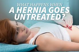 Will a hernia go away. What Happens When A Hernia Goes Untreated The Surgery Group