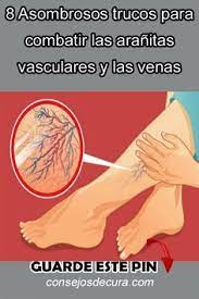 8 Asombrosos Trucos Para Combatir Las Aranitas Vasculares Y Las Venas Asombrosos Trucos Productos Para La Salud Remedios Para La Salud Recetas Para La Salud