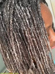 We all know that hydrogen peroxide is an ingredient that is included in most commercial hair dyes. Hydrogen Peroxide And Baking Soda On Black Hair My Locks Journey