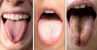 Que Significan Los Distintos Colores De La Lengua Bioguia