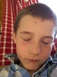 Stig-Erik Molstad Je (@stig_je)