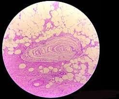 Any deformation in the corpuscle causes action potentials to be generated by opening. Category Lamellar Corpuscle Wikimedia Commons