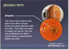 Pin On The Medical Side Of Optometry