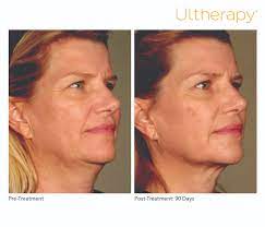 Surrogacy costs can vary depending which arrangement you choose and in which country. Ultherapy Cost In San Antonio Cosmetic Surgeon San Antonio Cosmetic Surgery Dr Koneru