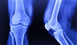 Missoula bone & joint phone directory. B One Ortho
