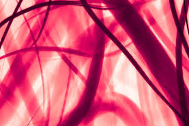 Image result for Cerebrospinal Fluid Color