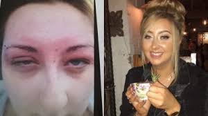 We did not find results for: Woman Who Developed Life Threatening Allergy To Black Henna Warns Others Of Risks Itv News Wales