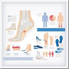 Best Foot Forward To Avoid Plantar Fasciitis Chiropractor Anchorage Physical Therapy Accident Injury Center