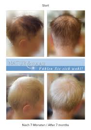 Unser team präsentiert eine menge schöne frisuren für lange haare, damit sie zu jeder zeit ihre innere und äußere schönheit ausstrahlen. Dichtere Haare In Naturhaarfarbe Nach 7 Monaten Ganzheitlich Naturlich