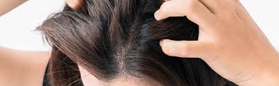 Once conditions have improved, the hair will most likely grow back. Itchy Scalp Overview About Potential Causes