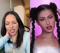 Toni Fowler Finger Issue