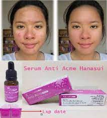 Di bagian belakang karton ada beberapa keterangan produk yang menurutku sangat lengkap seperti deskripsi produk, ingredients list, cara pakai, detail manufaktur, nomor bpom, batch no., dan expiry date. Serum Acne Hanasui Pink Bpom Shopee Indonesia