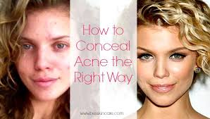 how to conceal a pimple with makeup