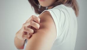 Dermatographism and swelling (angioedema) may accompany hives (urticaria). Eperszezonban Gyakrabban Jelentkezik Csalankiutes Well Fit