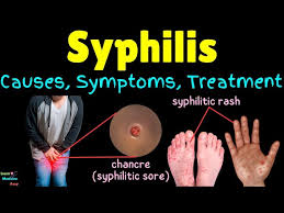 Image result for syphilis symptoms
