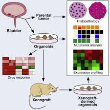 Bladder cancer symptoms range from lower back pain to blood in your urine. Tumor Evolution And Drug Response In Patient Derived Organoid Models Of Bladder Cancer Sciencedirect