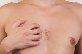 Pada masa tenang, orang itu tidak akan memiliki gejala. 4 Komplikasi Akibat Lupus Yang Harus Diperhatikan