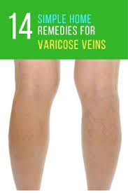 Pin On Natural Home Remedies