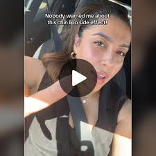 Chin Lipo Side Effects You Need to Know