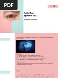 Image result for Seidel Test
