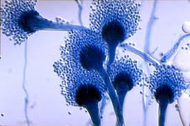 Aspergillosis (aspergillus infection) is a fungal infection. Aspergillus Fumigatus And Aspergillosis Microbewiki