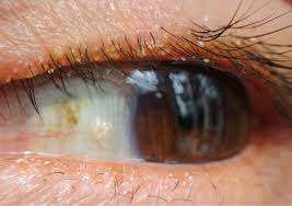 Image result for Blepharis sol