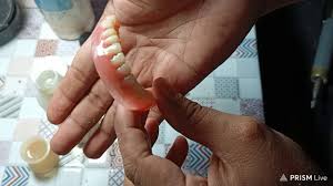 We did not find results for: Cara Menyambung Gigi Palsu Yang Patah How To Join Broken Dentures Youtube