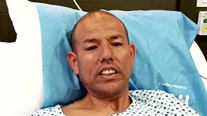 Neuralgia de Trigémino Clásica Derecha...