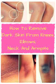 We did not find results for: How To Remove Dark Skin From Knees Elbows Neck And Armpits Dark Spots On Skin Dark Elbows Skin Spots