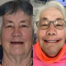 Local oral surgeons give back in 'Smiles for Soldiers' program