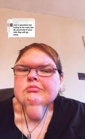 1000-Lb. Sisters' Tammy Slaton debuts plastic surgery