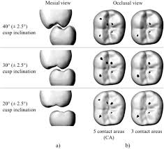 Image result for Occlusal