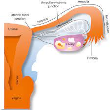 Fallopian tube cancer is a rare malignancy (progressively worsening), accounting for 0.5% of all female gynecological cancers. Fallopian Tube An Overview Sciencedirect Topics