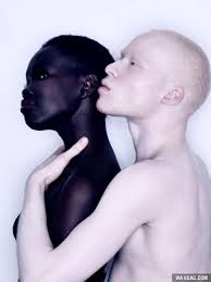 This Is How The Darkest And The Lightest Men Look Like Original Photo Without Photoshop Albinism Black Is Beautiful Black Beauties