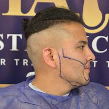 Sakal Ekimi Nedir? Sakal Ekimi Fiyatları