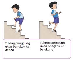 Gangguan Atau Kelainan Sistem Organ Manusia Halaman 181 Belajar Kurikulum 2013