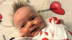 Urgent appeal to find a stem cell donor for a 3-month-old baby girl