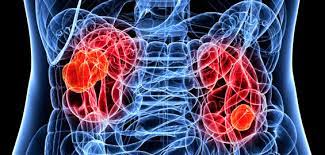 Informatii financiare şi fiscale status la data 31/12/2015: Medic Urolog Satu Mare Examen Clinic Prostata Cistoscopie